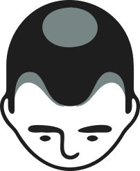 Extensive Hair loss