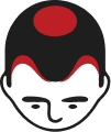 Stage 4