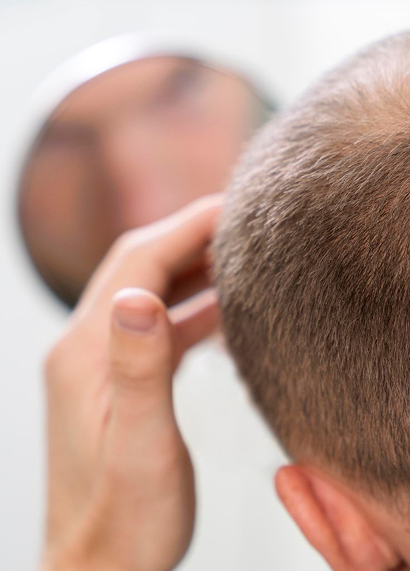 Does scalp health affect regrowth?